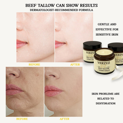 Beef Tallow for Skin and Face – Tallow and Honey Balm Moisturizer, 100% Grass-Fed Beef Tallow with Raw Organic Honey, Beeswax, Olive Oil & Vitamin E – Deep Hydration – Proudly Made in USA – 2oz