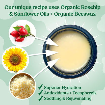 Organic Beef Tallow Balm with Rosehip Oil | Unscented 1 oz – Hand Made in USA 100% Grass-Fed Beef Tallow Moisturizer for Face & Body, Baby, Eczema, Acne-Prone & Sensitive Skin