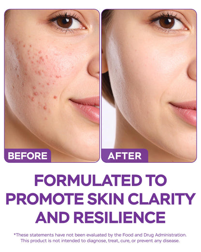 4Well Products Dim Supplement 370mg Complex with Zinc, Niacinamide - Estrogen Blocker for Women & Men, Hormone Balance - Hormonal Acne, Menopause and Antioxidant Support, Diindolylmethane 30 Capsules